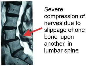 MedX, non-surgical, conservative, conservative care, medical, lumbar, cervical, spina, idd, idd therapy, therapy, accu-spina, drx9000, drx 9000, lordex, VAX-D, traction, muscles, back, low back pain, back pain, pain, spine, leg pain, sciatica, lumbar, cervical, disc, herniated disc, houston, texas, usa, america, conservative, non-surgical, institute, britain, france, saudi arabia, dubai, mexico, puerto rico