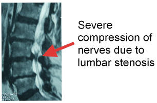 MedX, non-surgical, conservative, conservative care, medical, lumbar, cervical, spina, idd, idd therapy, therapy, accu-spina, drx9000, drx 9000, lordex, VAX-D, traction, muscles, back, low back pain, back pain, pain, spine, leg pain, sciatica, lumbar, cervical, disc, herniated disc, houston, texas, usa, america, conservative, non-surgical, institute, britain, france, saudi arabia, dubai, mexico, puerto rico