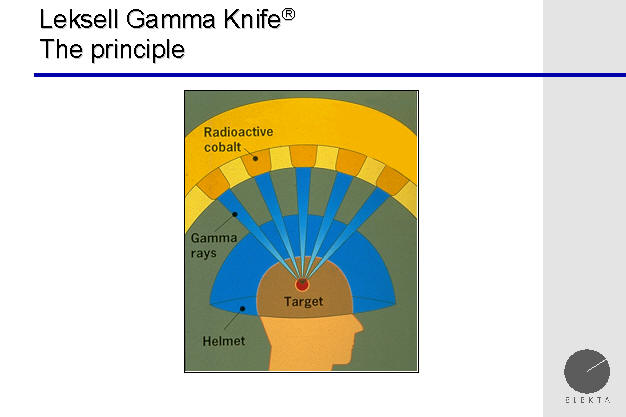 the gamma rays are collinear, converging on the target, brain tumor