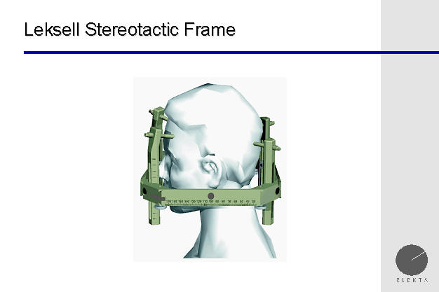 leksell g frame for stereotactic treatment