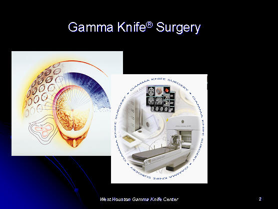 gamma knife review, Houston, Texas, TX, USA