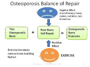 osteoporosis balance of repair of fractures, Houston, Texas