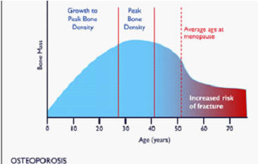 osteoporosis increases with age