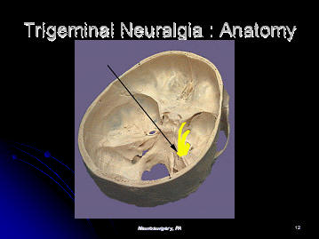 trigeminal nerve anatomy