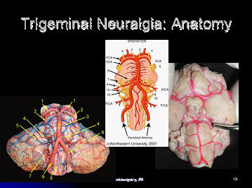 trigeminal nerve anatomy, branches, houston, tx, texas, usa